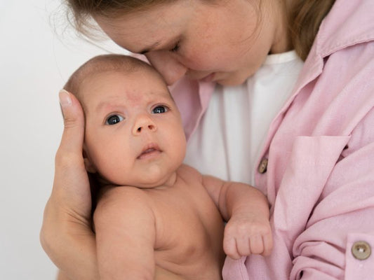 Alergi pada Bayi ASI